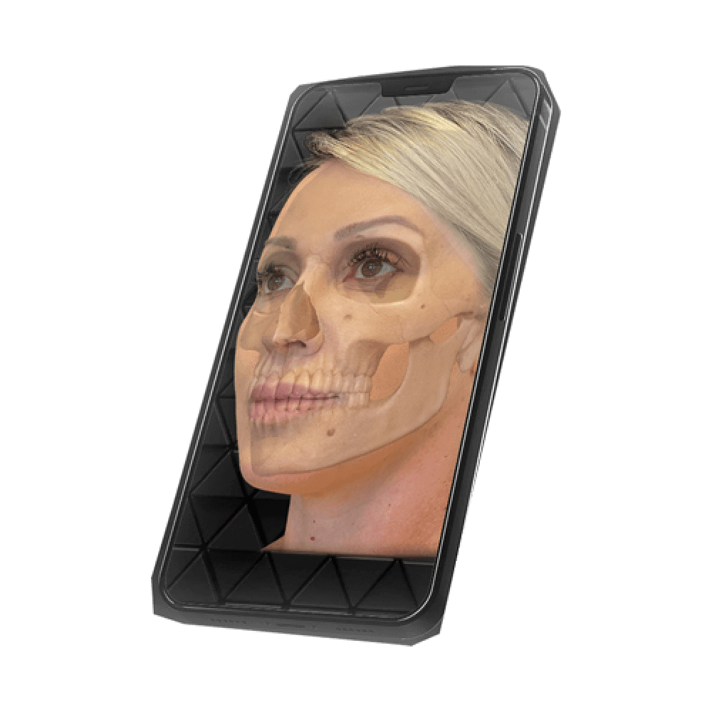 Imagem com um filtro para uma face