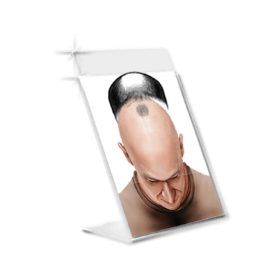 Imagem do display de calvície masculina